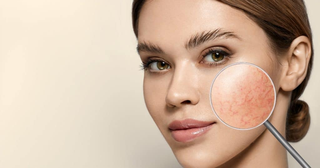 Lumecca | EMME Medical Spa | Orchard Park, NY