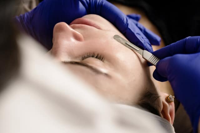Dermaplaning1