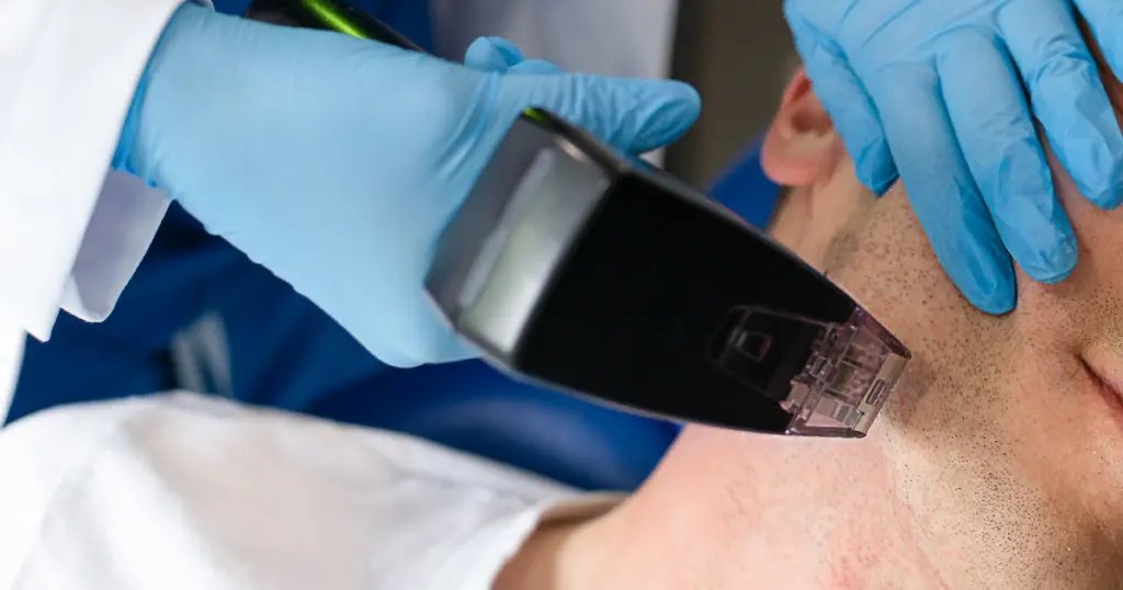 Man receiving Morpheus8 treatment in Orchard Park, NY