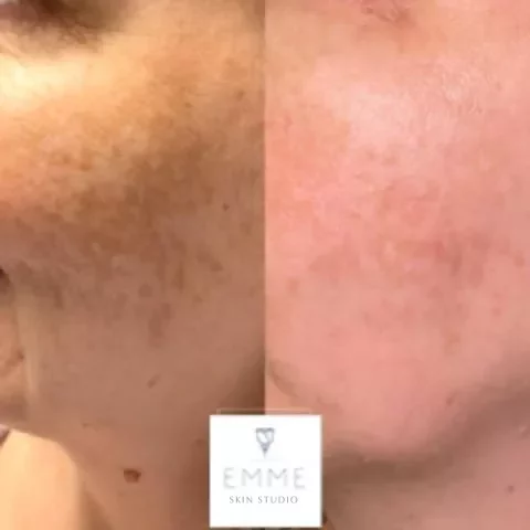 emmedmedicalspa-zoskin